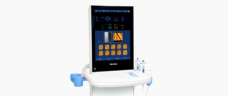 Fibroscan