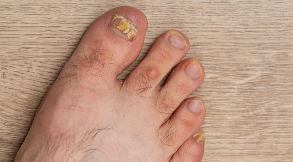 endokrnolojia