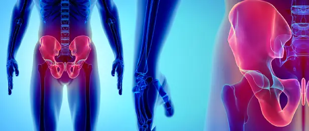 Hip Surgery