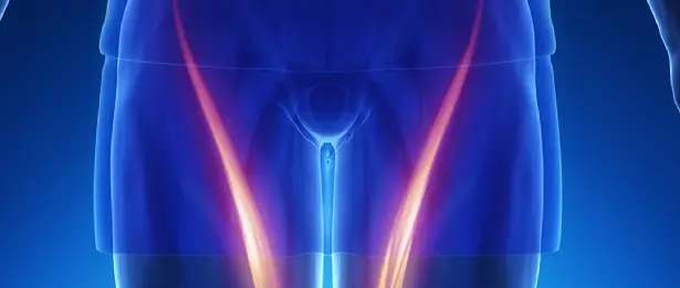 Chirurgie des hernies inguinales et de la paroi abdominale