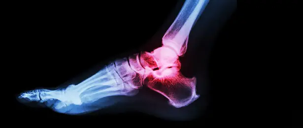 Foot and Ankle Surgery