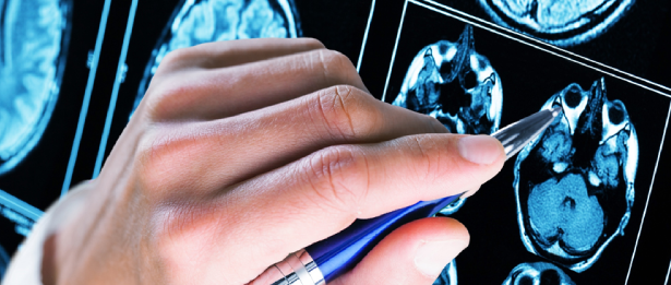 Chirurgie de l'épilepsie