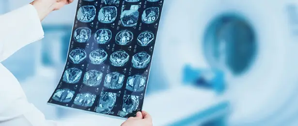 Neuroradiology